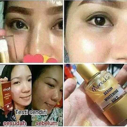 Moreskin Serum Whitening Gold Serum Pemutih Wajah dan Pencerah Wajah