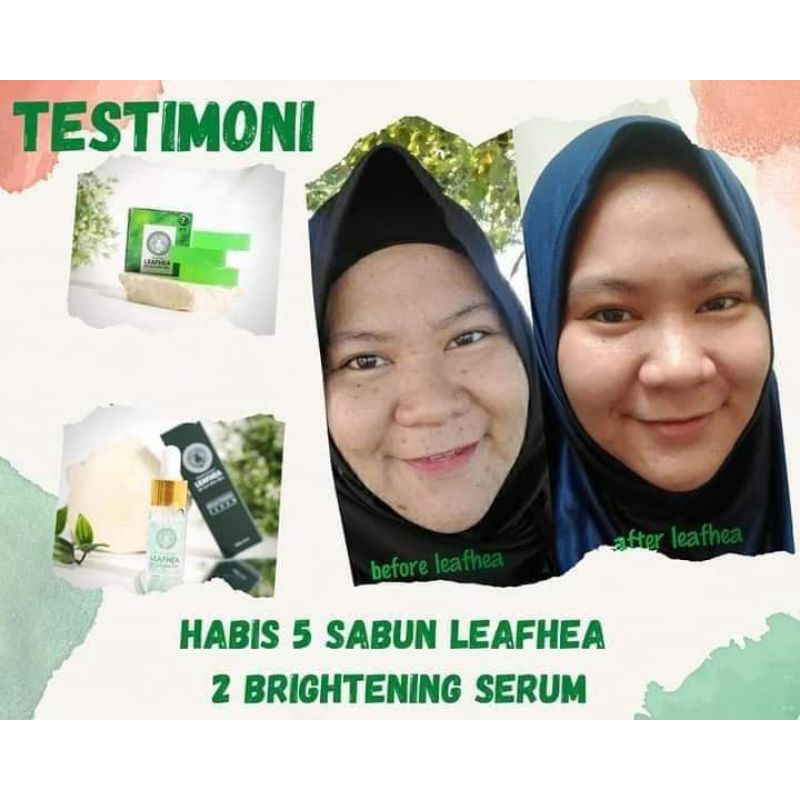 SIMPLE FLEK HITAM BEKAS JERAWAT