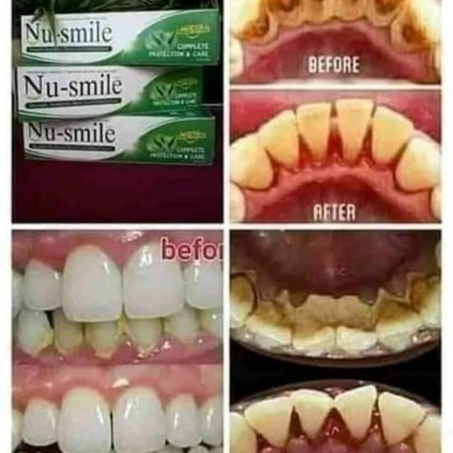 Nu smile