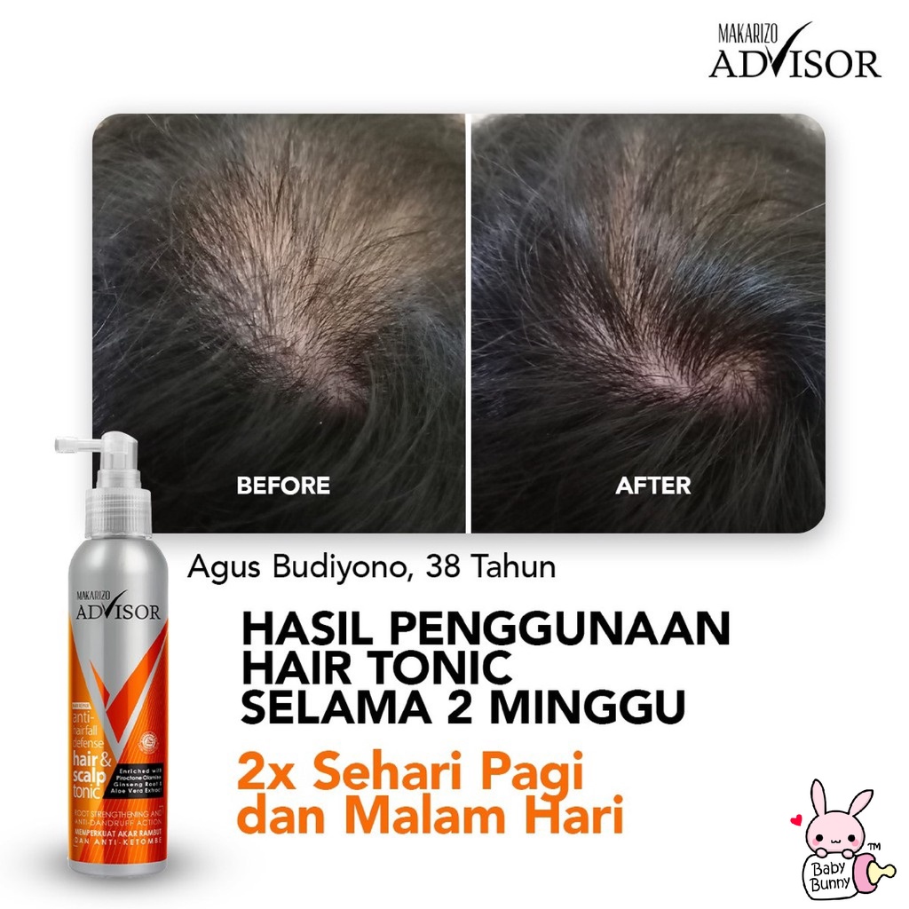 ❤ BELIA ❤ MAKARIZO Advisor Hair &amp; Scalp Tonic 145mL &amp; 65ml | Perawatan Rambut Rontok dan Ketombe (BPOM)