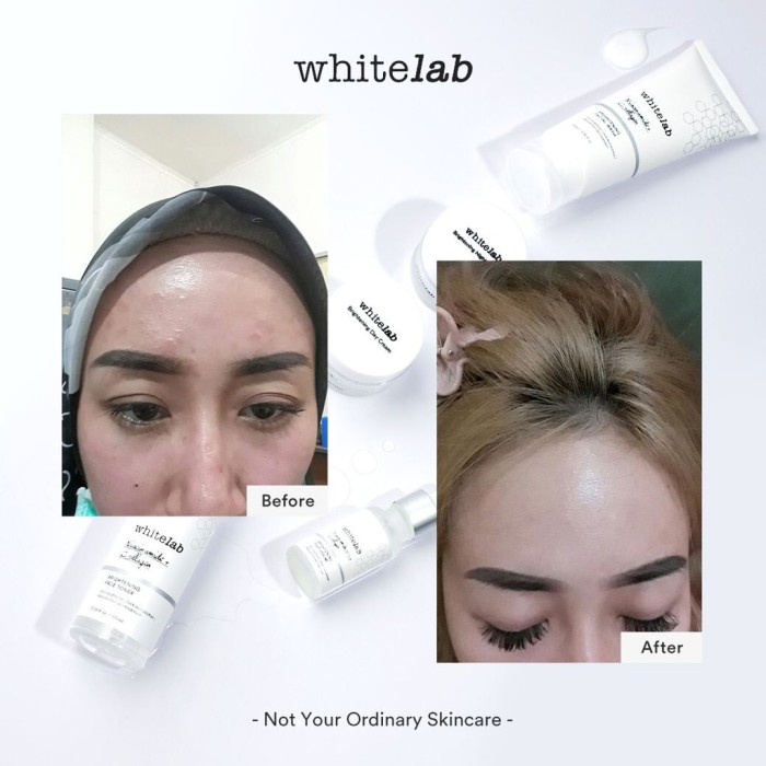 Whitelab Brightening Face Series BPOM Original