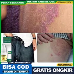 Obat Selangkangan dan Bokong, Gatal Selangkangan dan miss v, Selangkangan Hitam Original Propolis SM