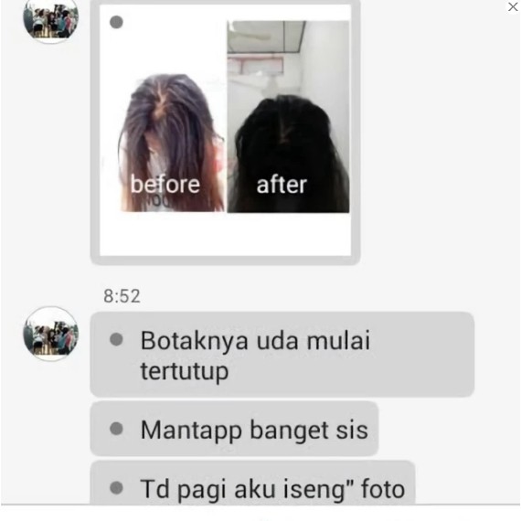 Paket Maksimal Green Angelica Shampoo Tonic Serum Untuk  Rambut Rontok Menipis Botak