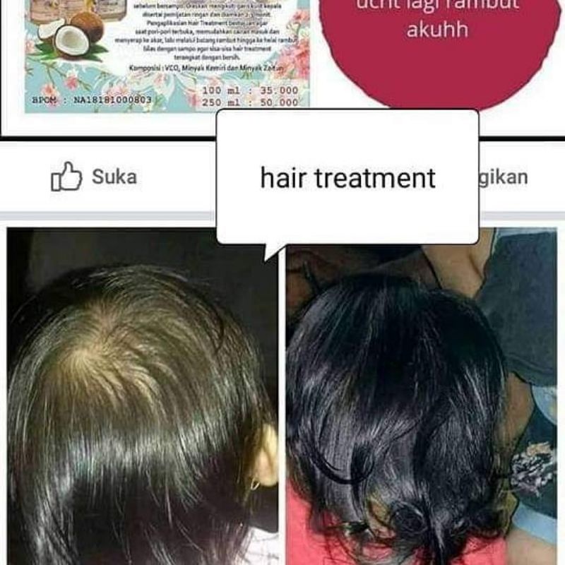 Baby hair treatment/ Penumbuh rambut anak/melebatkan rambut/menghitamkan rambut bahan alami bpom