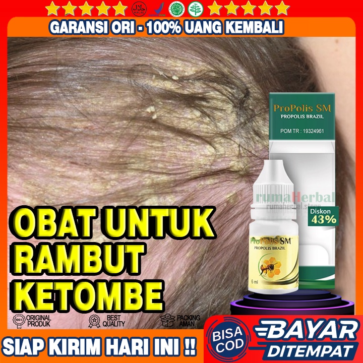 Obat Ketombe Parah, Penghilang Koreng di Kepala, Psoriasis Kepala, Kurap di Kepala, Folikulitis