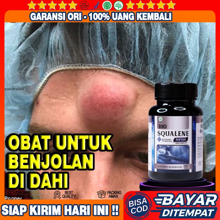 Obat Benjolan Di Dahi - Obat Benjolan Di Jidat - Obat Alami Untuk Benjolan Di Dahi - Penumpas Benjol