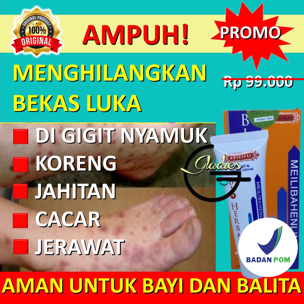 Obat Penghilang Bekas Luka Menghilangkan Bekas Luka Lama Hitam Koreng Ampuh Di Wajah Di Kaki BPOM