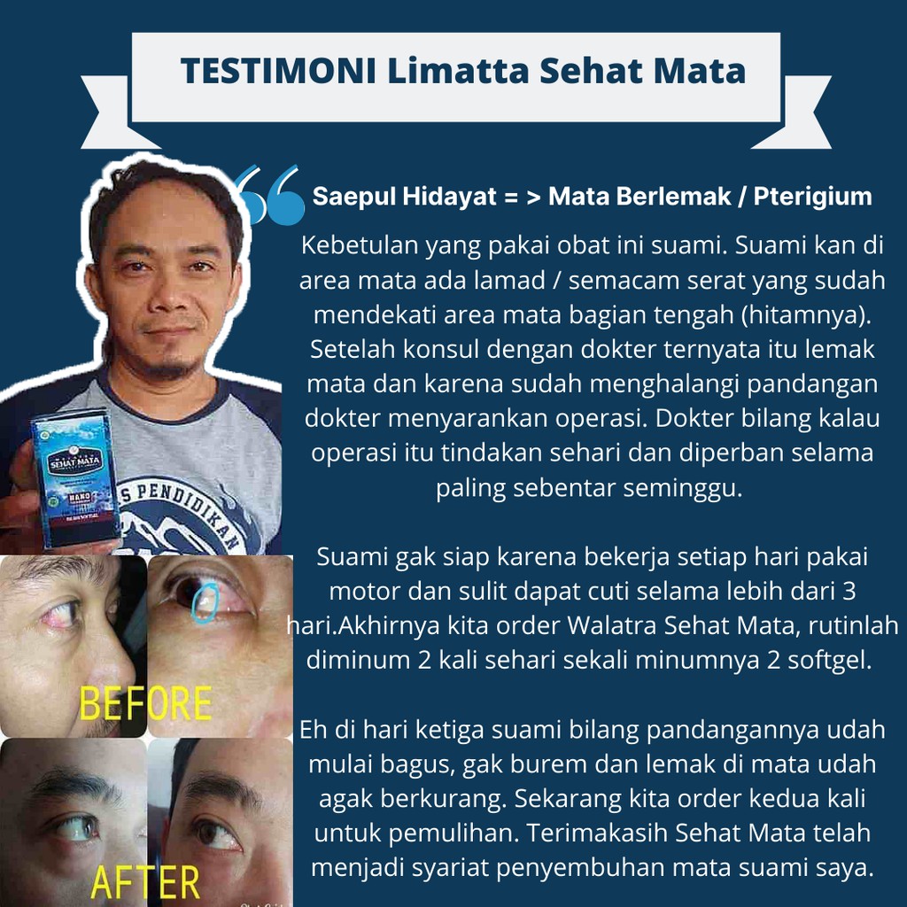 Sehat Mata Limatta Original Spesialis Obat Penyakit Mata Legalitas Bpom Berkualitas Unggul Shopee Indonesia