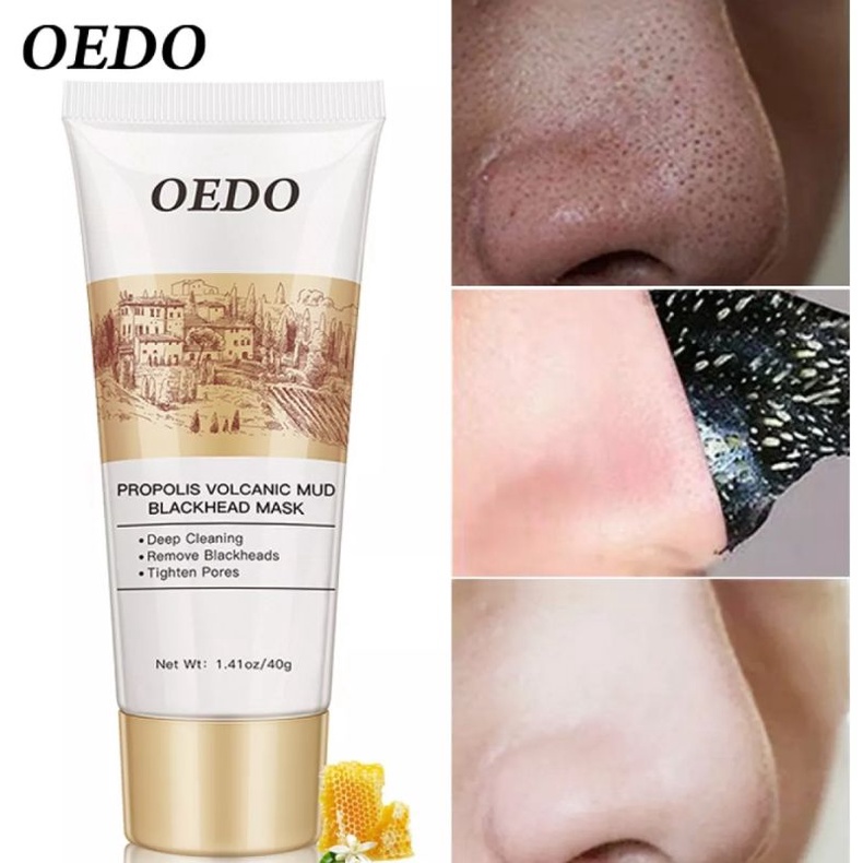 OEDO VOLCANIC SOIL FACIAL ACNE REMOVE BLACKHEAD MITE PROPOLIS FACE CARE PEMBERSIH KOMEDO BLACKHEAD-60ml