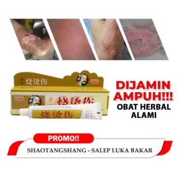 [ BAYAR DITEMPAT ] SALEP CREAM HUATUO SHAO TANG SHANG SALEP HERBAL CINA OBAT LUKA BAKAR PENGHILANG BEKAS LUKA Huatuo Salep Herbal Obat Luka Bakar &amp; Kena Air Panas Minyak Panas Kulit Melepuh Ampuh ORIGINAL ASLI SALEP AMPUH MENGOBATI KULIT MELEPUH