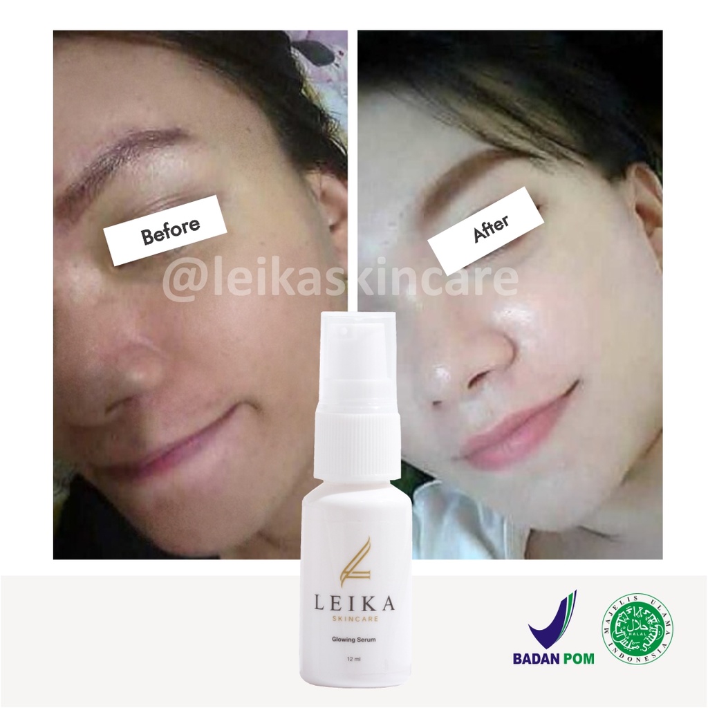 Serum Pemutih Kulit Wajah Resmi BPOM Skincare Serum Glowing Viral Rekomendasi Pemutih Kulit Wajah Se