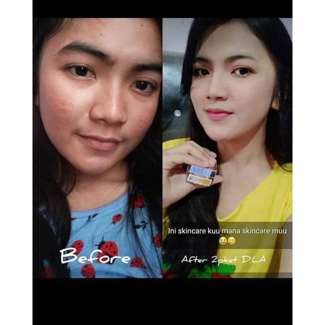 D'LA Skincare krim malam