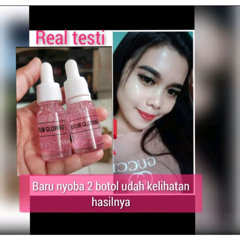 SERUM LITERAN/LITERAN GLOWING,ACNE,FLEK,BOPENG,GOLD