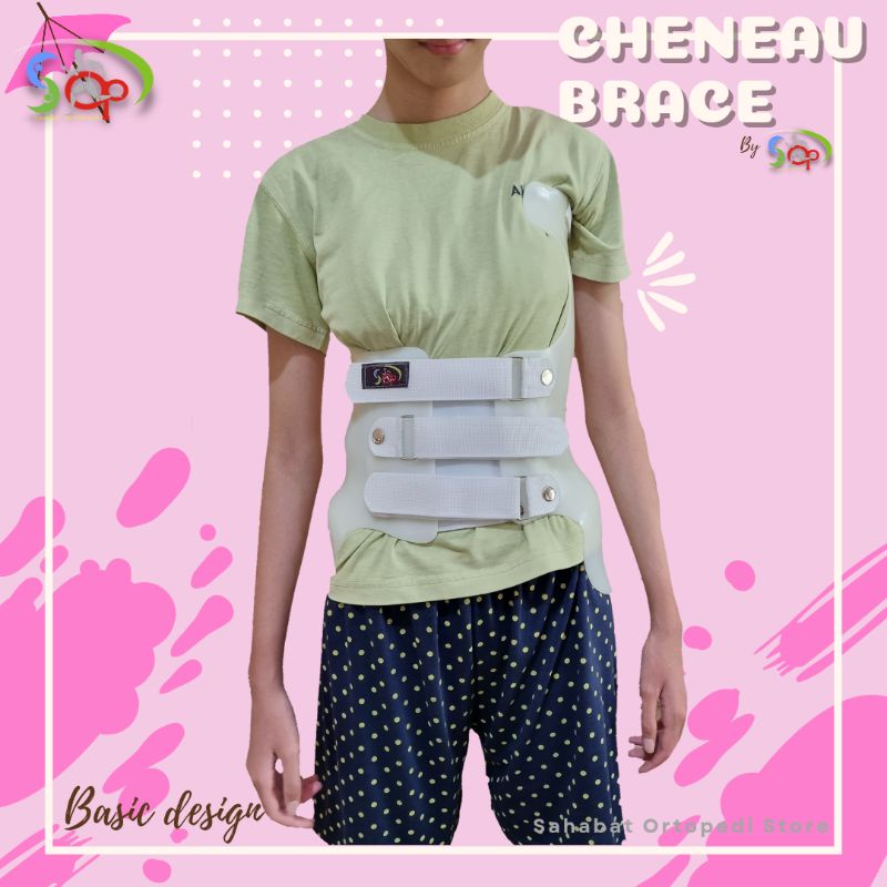 Skoliosis Brace / Scoliosis Brace / Cheneau Brace