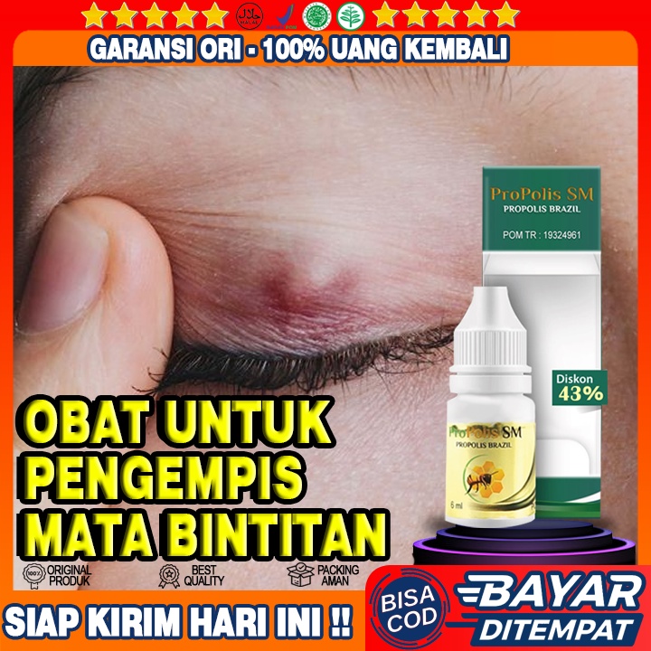 Salep Pengempis Mata Bintitan, Salep Timbilan Mata, Salep Buat Bintitan Mata, Salep Untuk Mata Binti