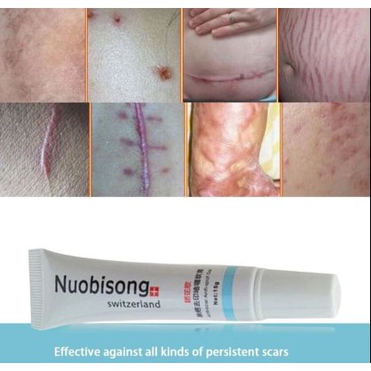 Super Promo Nuobisong anti spot and scar gel / Obat Bekas Jerawat luka