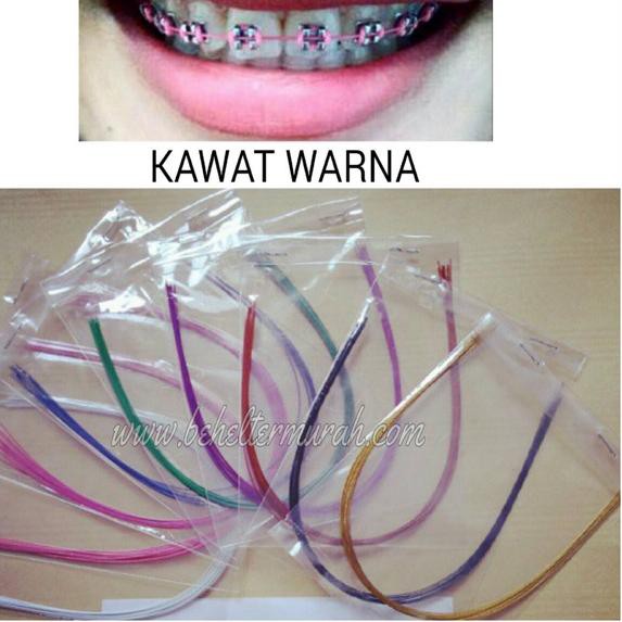 ⁂zdw-315 Kawat warna niti behel permanen : KAWAT gigi ,