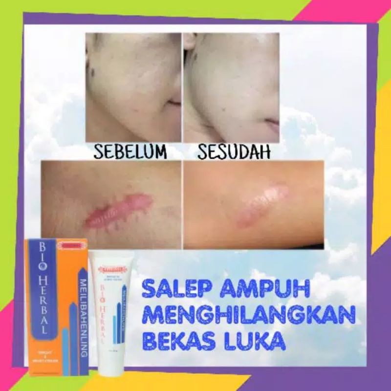 [COD] Penghilang Bekas Luka Ampuh 7 Hari Flek Hitam luka Bakar Cacar Gatal penghilang bekas hitam