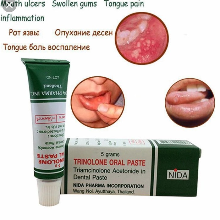 OBAT SARIAWAN Trinolone Oral Paste