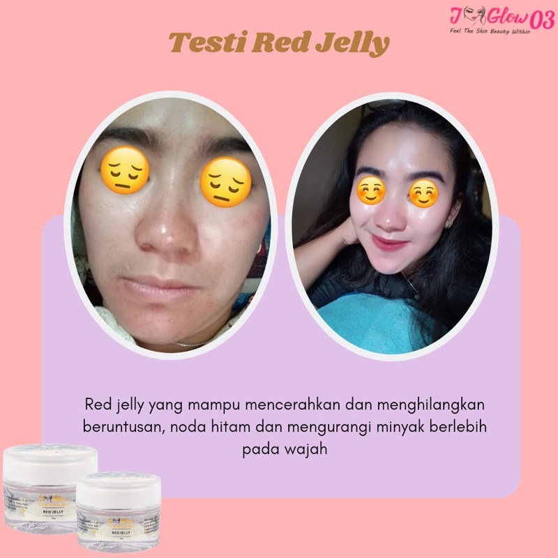 J-Glow Red Jelly Jglow / Skincare Jglow Red Jelly JGLOW