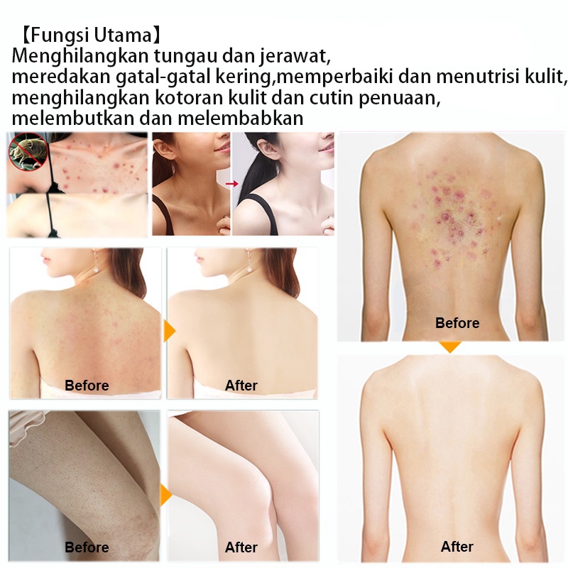 [IUallure] Body Wash Sabun Mandi Menghilangkan Jerawat 260ml Repair Skin / Brightening / 100% herbal / Original Product