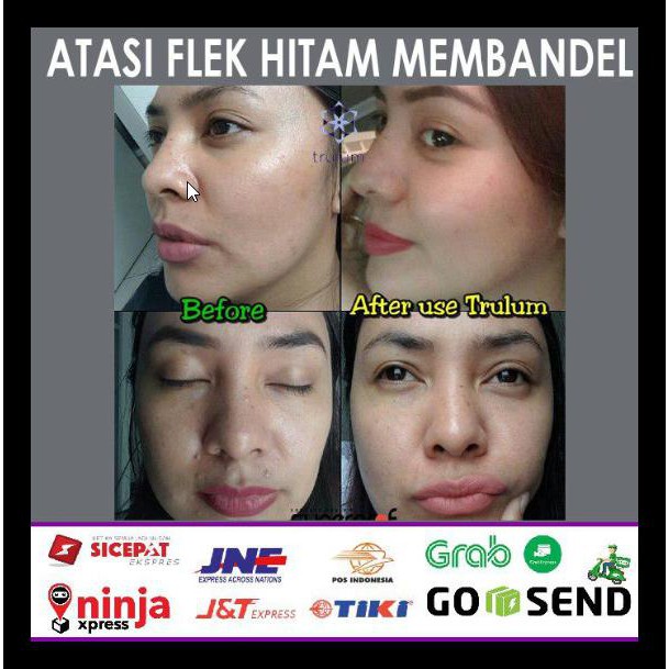 Trulum 120ml 15ml 5ml Pengganti Krim Flek Hitam Ampuh Termurah Shopee Indonesia