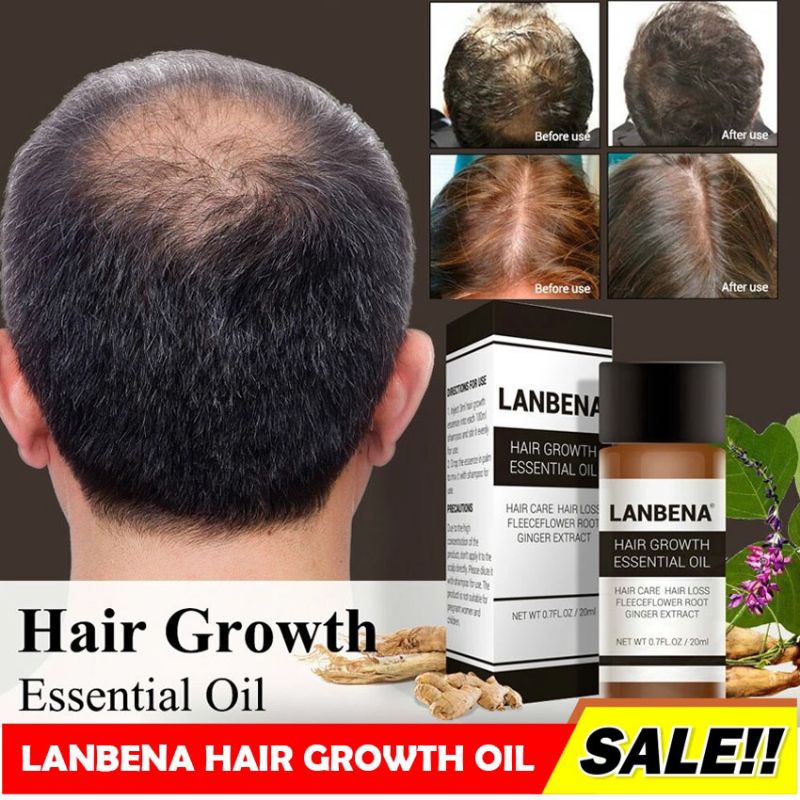 Serum Penumbuh Rambut Dan Mecegah Kebotakan Labena Hair Growth Oil Serum Ampuh Menumbuhkan Rambut Botak Serum Rambut Pria Dan Wanita