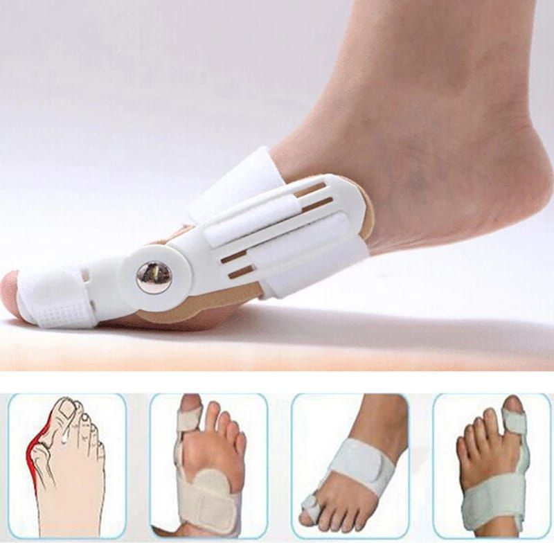 BUNION CORRECTOR SPLINT ALAT TERAPI KAKI BUNION HALLUX VALGUS TERAPI JARI KAKI BENGKOK INSOLE SEPATU