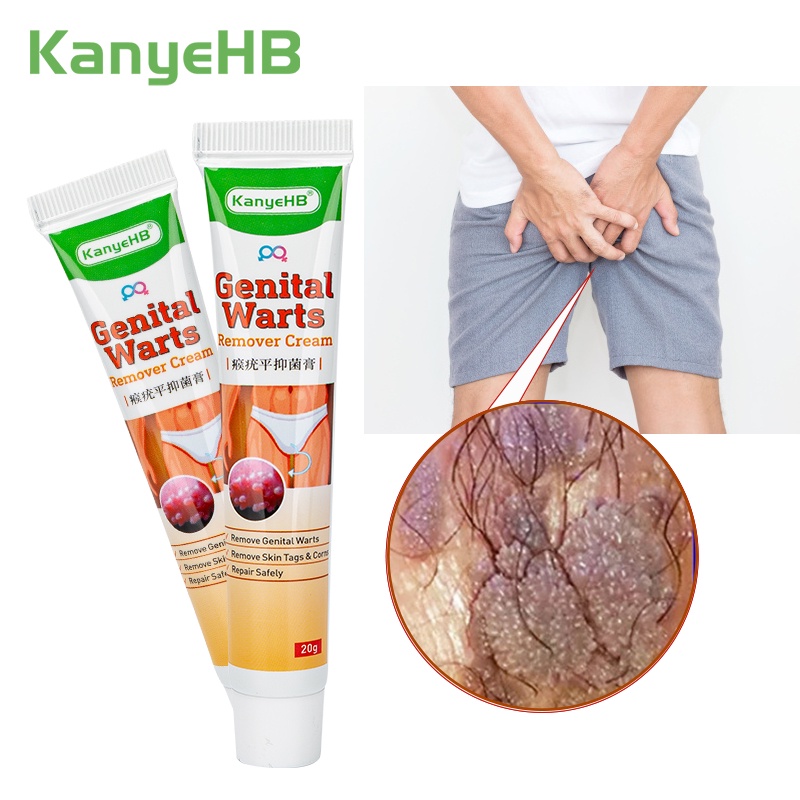 1pc Genital Warts Remover Cream Herpes Genital Vulva Condyloma Acuminatum Skin Tag Remover 2724