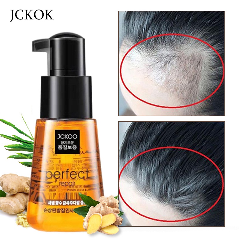 Serum rambut rontok Shampo anti rontok Serum rambut botak prevent hair loss hair growth essence oil 70ml dan spray 30ml penumbuh rambut Rambut kering, kusut, ujung bercabang, perm dicat Memperbaiki Tidak perlu dicuci