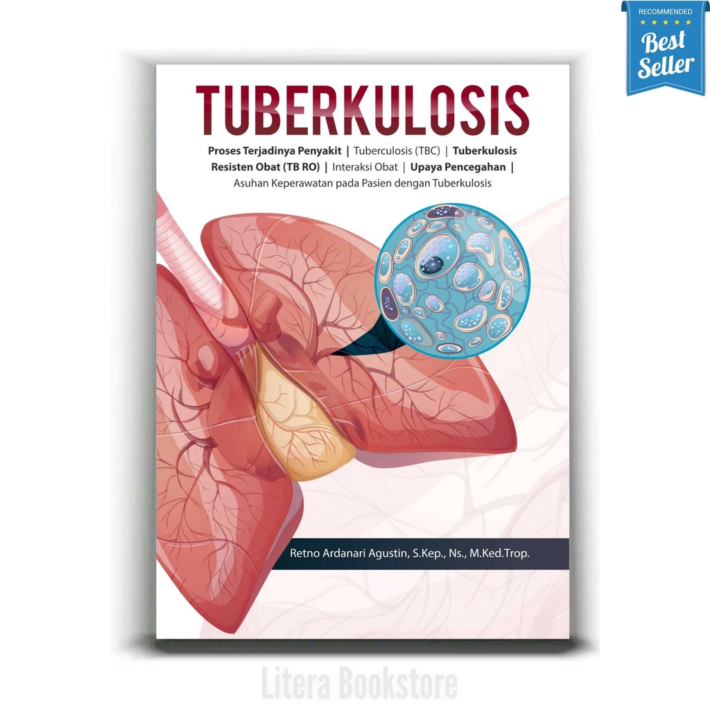 Buku Tuberkulosis