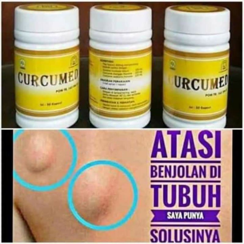 CurcumedNasaUntukMengobatiKista&Tumor
