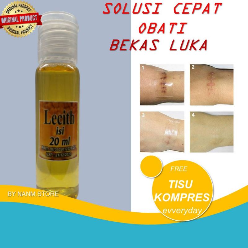 Obat Penghilang Keloid TERBARU TERMURAH PALING AMPUH