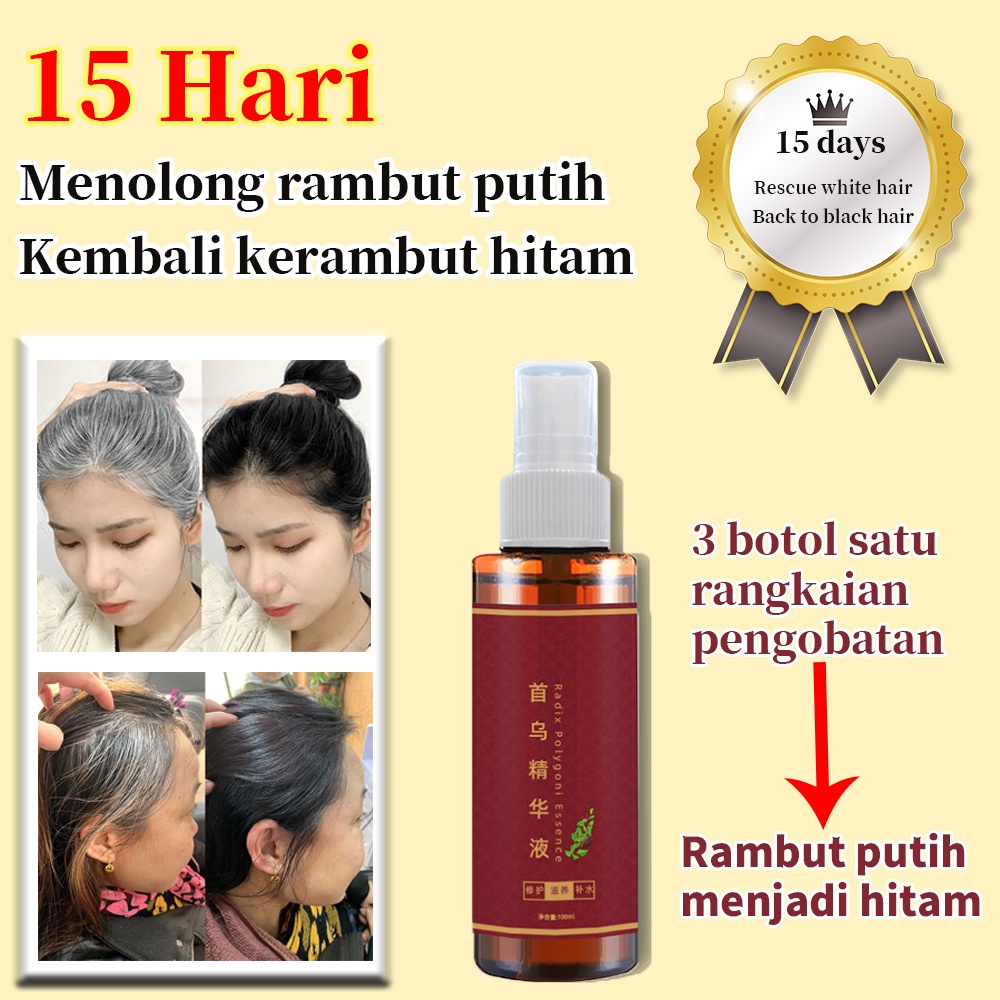 【O'RANNLE】Rambut putih cepat menghitam Serum rambut cat rambut hitam semprotan esensi rambut hitam 100ml hair treatment he shou wu memelihara dan memperbaiki anti Hair color penghitam rambut uban Sin Hair