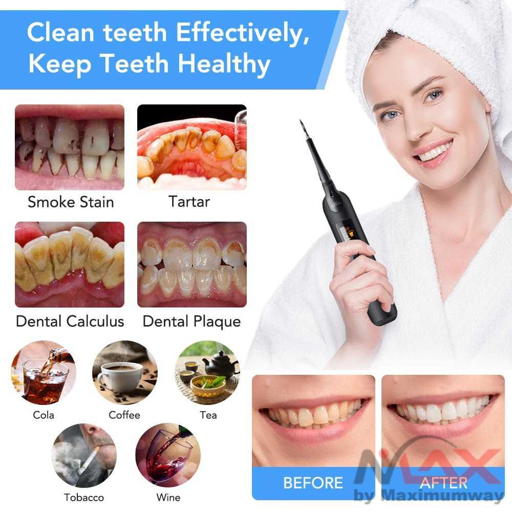 Hailicare Pembersih Gigi Elektrik Dental Tartar Remover With LCD LR-6 Warna Hitam