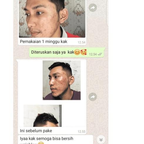 [Original] SERUM MENLAB HYDRATING SKIN SERUM MENLAB HYDRATING SERUM | MEN LAB SERUM PRIA ORIGINAL 10