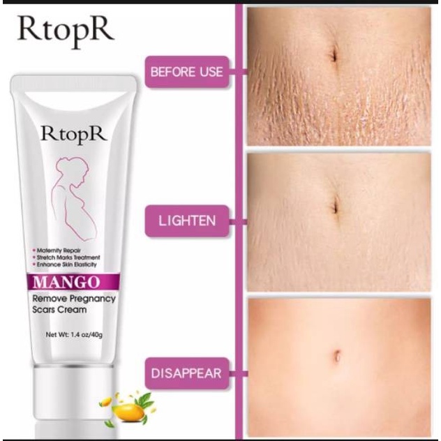 _PROMO_CREAM_PENGHILANG_SELULIT_RTOPR_MANGO_