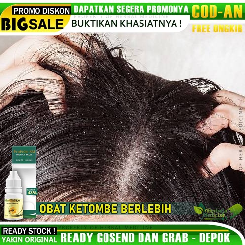 Obat Ketombe Parah - Ketombe Berkerak - Ketombe Menahun - Jamur Kulit Kepala Dengan Propolis SM