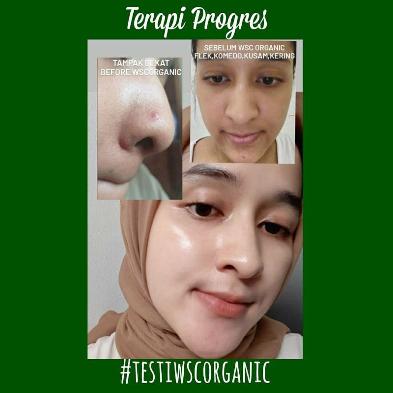 WSC ORGANIK NORMAL WHITENING,ACNE, FLEK ( FREE SERUM )