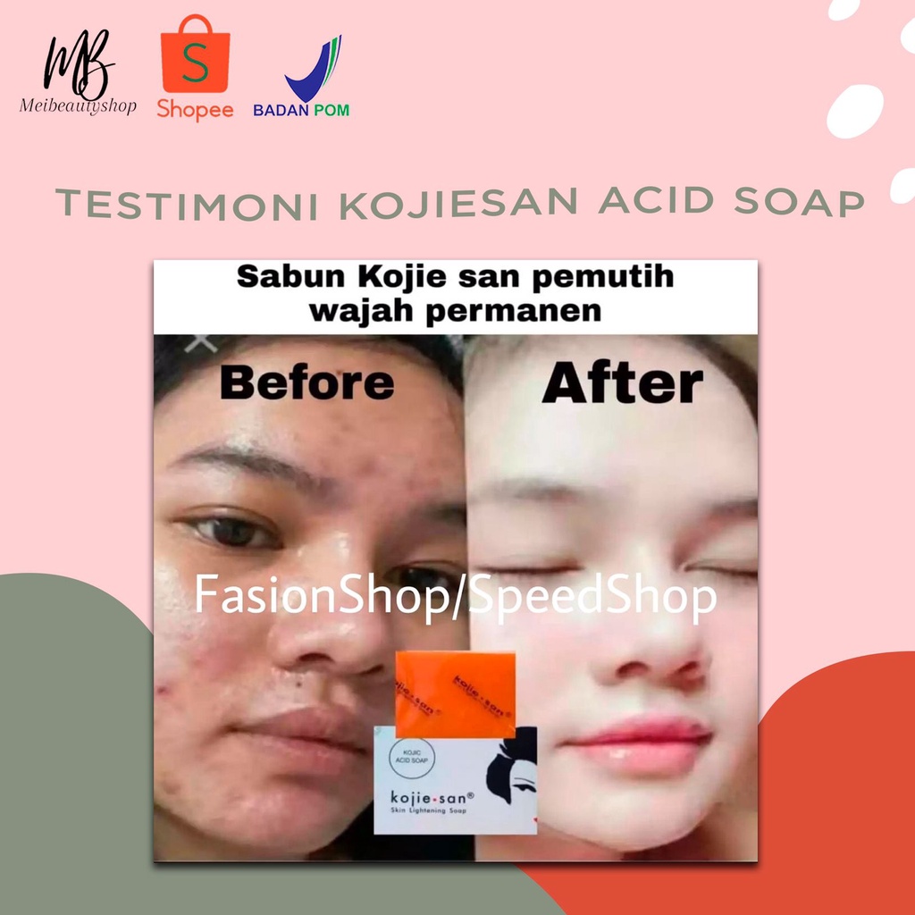 KOJIE SAN Skin Lightening Soap / Kojiesan Soap / Sabun Pemutih