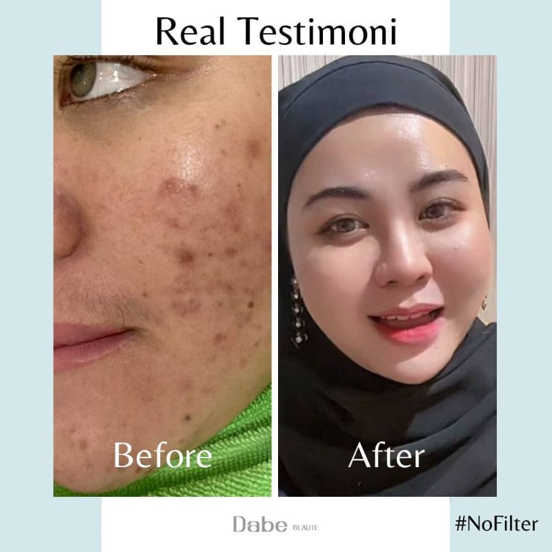 ***FREE HADIAH*** DABE BEAUTE SKINCARE TERLARIS 2022