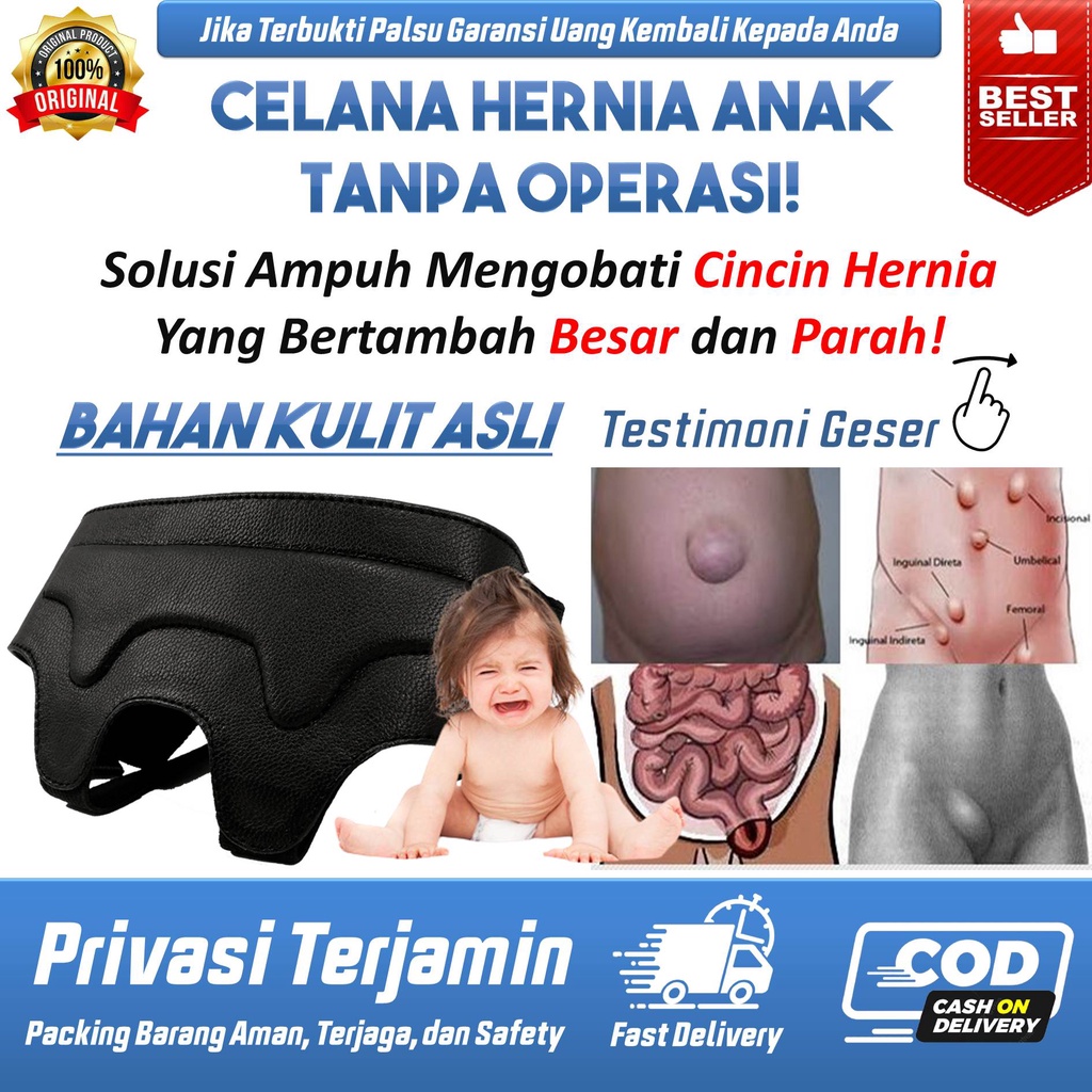 Celana Hernia Anak, Bayi, Celana Dalam Hernia Non Magnetik, Hernia Turun Berok Pria Wanita Butterfly