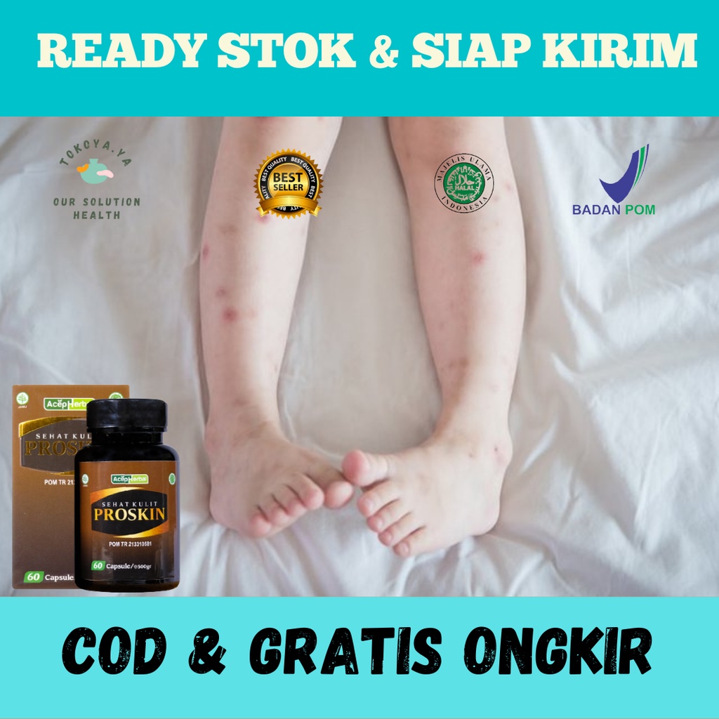 Obat penghilang bekas luka hitam koreng di kaki lama, Obat Menghilangkan Bekas Luka Lama Hitam Koren