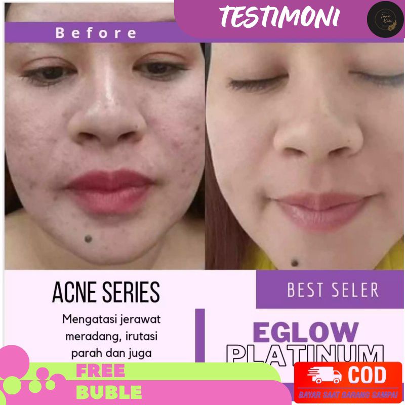 [ COD ] Eglow Platinum Ori Paket Pemutih wajah Eglow BPOM 100% ORIGINAL - Paket Wahitening Paket Acne