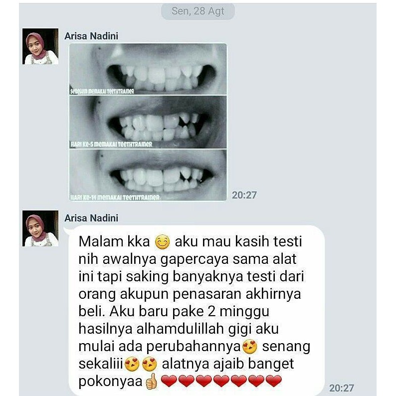 [Putih] Perapi Gigi Tanpa Behel dari Bahan Silikon Orthodentic Retainer Teeth Ampuh dalam 3 Bulan