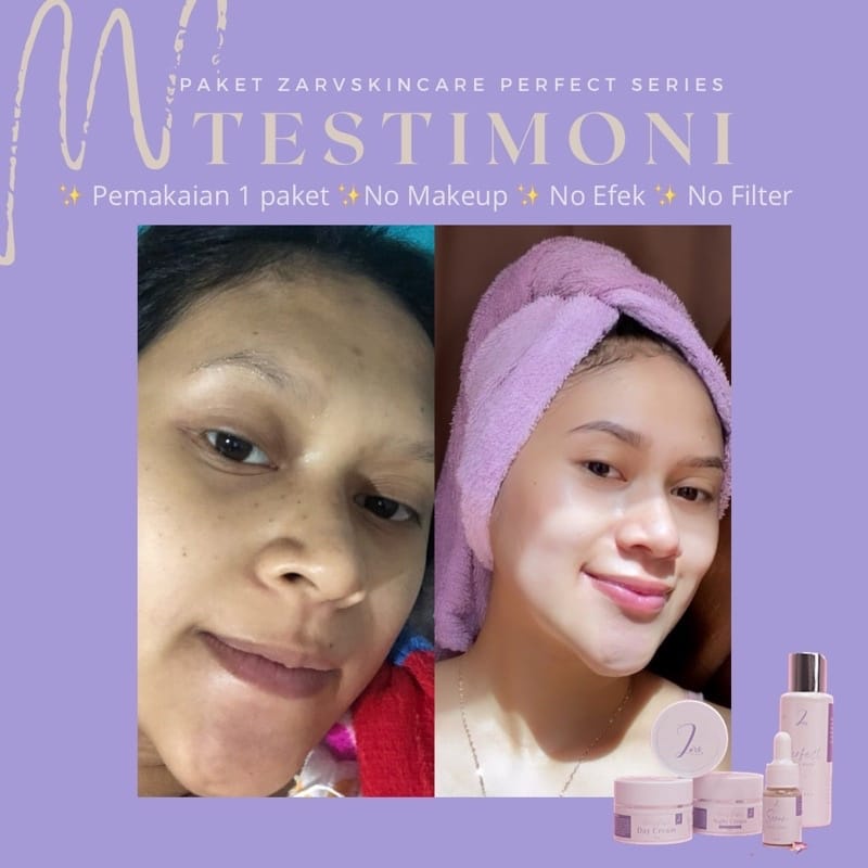[FREE HADIAH] Paket Pemutih Wajah Glowing Perfect Series Zarv Skincare Pemutih Wajah Ampuh Permanen 