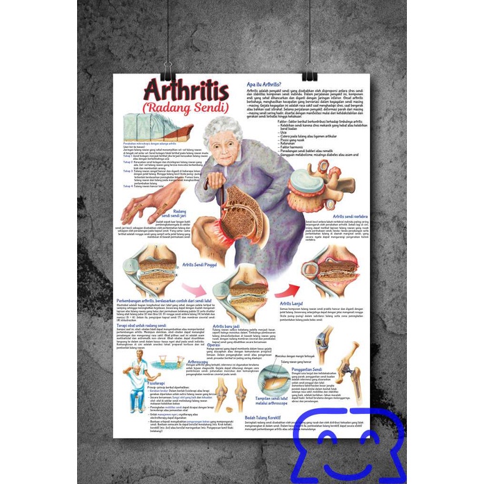 

SUPER BIG POSTER ATI SOBEK DAN TAHAN AIR Bahan Pearl ukuran A1 59,4cm x 84cm OSTEOPOROSIS, KEPADATAN TULANG, RADANG SENDI, ASAM URAT, REUMATIK