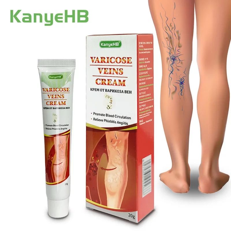 Obat Salep Krim VARISES / PARISES / FARISES / PARISES Di Kaki Dan Betis Tangan Paling Ampuh VARIKOKEL