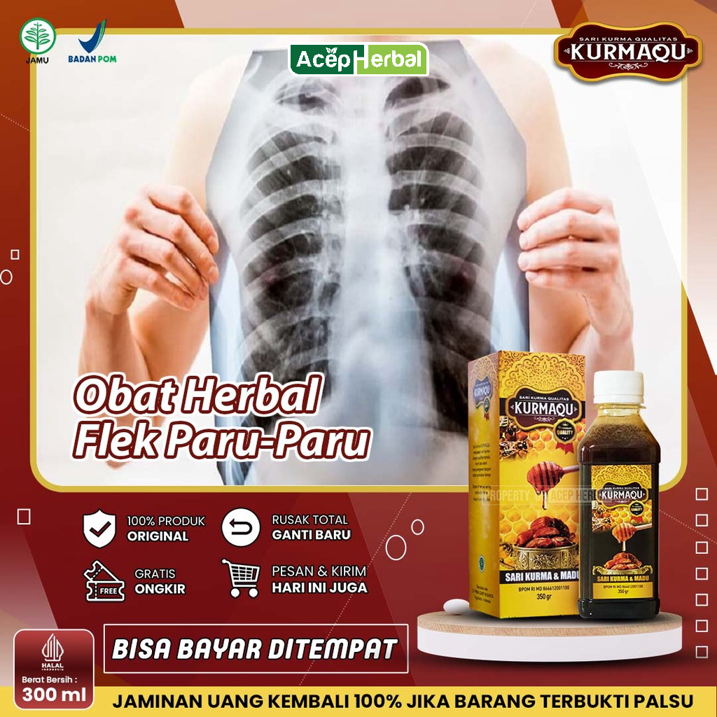 Jual Obat Flek Paru Paru Anak Dewasa Obat Tbc Paru Tbc Kelenjar Paru ...