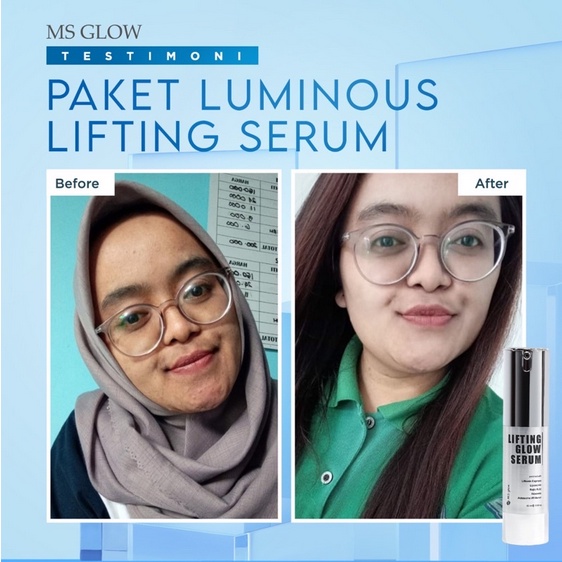 MS GLOW Lifting Serum ORIGINAL